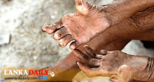 ලාදුරු වසංගතය යළි හිස ඔසවයි. වාර්ෂිකව රෝගීන් 2000ක්