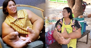ලොව විශාලතම දෑතේ හිමිකාරිය