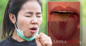 දිව රතුවෙන නව කොවිඩ් ප්‍රභේදයක් ! අවධානයෙන් සිටින ලෙස සෞඛ්‍ය අංශ දැනුම් දෙයි.