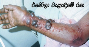 රිකිල්ලගස්කඩදී මිය ගියේ ඉබෝලා රෝගියෙක්ද?‍