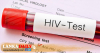 තරුණ ප්‍රජාව තුළ HIV සහ ලිංගාශ්‍රිත රෝග ඉහළට
