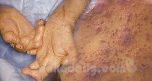 ලාදුරු සහ කාසේ වැඩිම බස්නාහිර පළාතේ