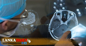 ආඝාත රෝගීන්ගේ වාර්තා වීම ඉහළට