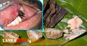 විට කෑමට පෙලඹීමෙන් පාසල් සිසුන් අතර මුඛ පිළිකා වර්ධනයක්