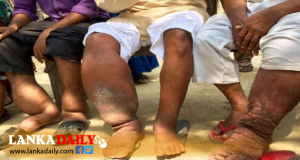බරවා රෝගීන් 27 ක් හඳුනාගැනේ